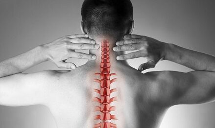 Como osteocondrose da coluna cervical se manifesta