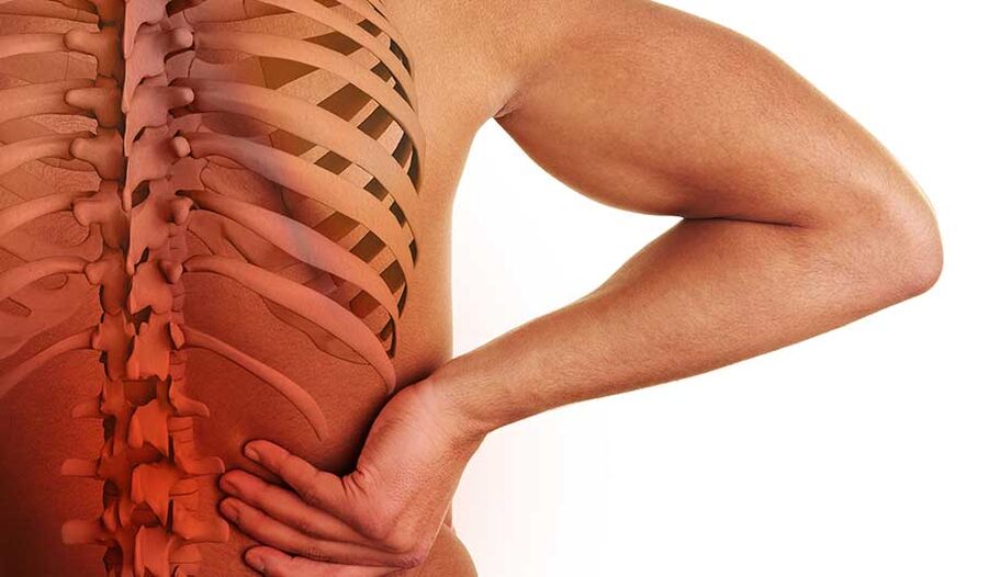 Osteocondrose da coluna lombar