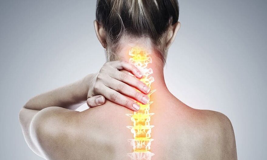 Osteocondrose da coluna cervical